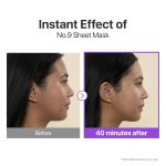 پک 4 عددی ماسک ورقه ای لیفتینگ صورت و غبغب NAD+ نامبوزین - 6